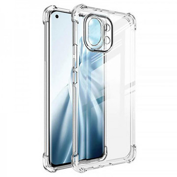 Чехол-накладка BeCover Anti-Shock Xiaomi Mi 11 Lite Clear (706073)